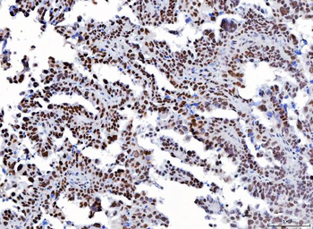 YY1 Mouse Monoclonal Antibody