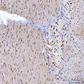 YY1 Mouse Monoclonal Antibody