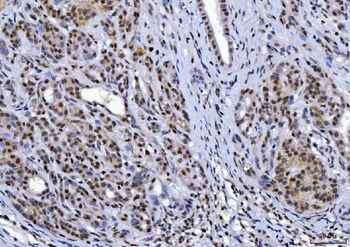 YY1 Mouse Monoclonal Antibody