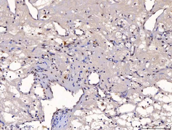 YY1 Mouse Monoclonal Antibody
