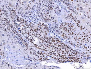 YY1 Mouse Monoclonal Antibody