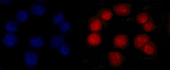MSH2 Mouse Monoclonal Antibody