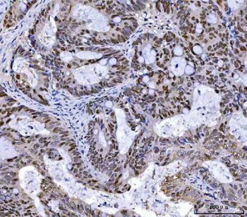 MSH2 Mouse Monoclonal Antibody