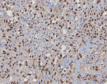 MSH2 Mouse Monoclonal Antibody