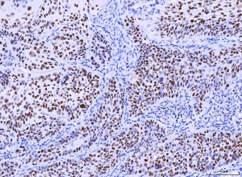 MSH2 Mouse Monoclonal Antibody