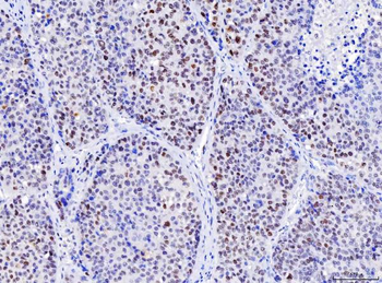 MSH2 Mouse Monoclonal Antibody