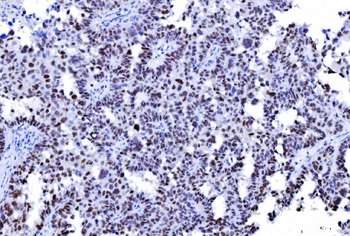 MSH2 Mouse Monoclonal Antibody