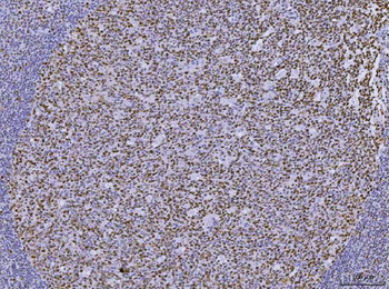 MSH2 Mouse Monoclonal Antibody