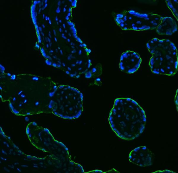 ALPP Mouse Monoclonal Antibody