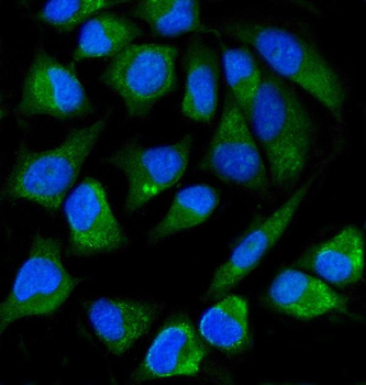 ALPP Mouse Monoclonal Antibody