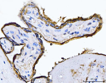 ALPP Mouse Monoclonal Antibody