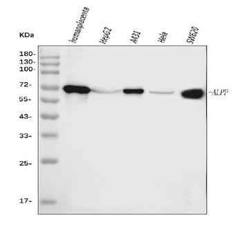 ALPP Mouse Monoclonal Antibody
