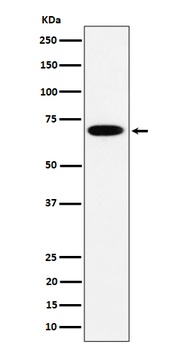 SLC27A4 Rabbit Monoclonal Antibody