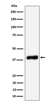 NSDHL Rabbit Monoclonal Antibody