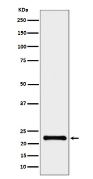 CRCP Rabbit Monoclonal Antibody