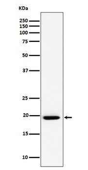 UFC1 Rabbit Monoclonal Antibody