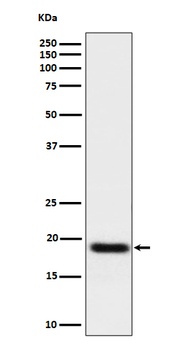 TNFAIP8 Rabbit Monoclonal Antibody