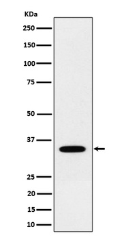 NTH1 Rabbit Monoclonal Antibody