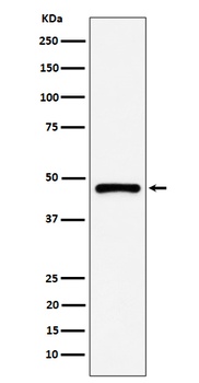 PSMC5 Rabbit Monoclonal Antibody