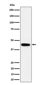 GALT Rabbit Monoclonal Antibody