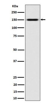 SLC12A1/NKCC2 Rabbit Monoclonal Antibody