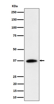 RASSF2 Rabbit Monoclonal Antibody