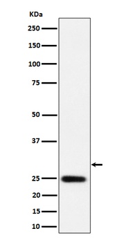 NAT1 Rabbit Monoclonal Antibody