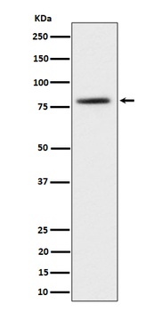 TORC2 Rabbit Monoclonal Antibody