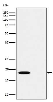 Phospho-PTS/PTS Rabbit Monoclonal Antibody