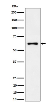 EYA2 Rabbit Monoclonal Antibody