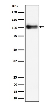 Thrombomodulin/CD141 Rabbit Monoclonal Antibody