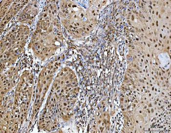 PRMT5 Rabbit Polyclonal Antibody
