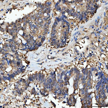 PRMT5 Rabbit Polyclonal Antibody