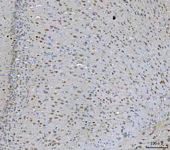 PRMT5 Rabbit Polyclonal Antibody