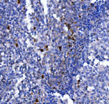 NCR1 Rabbit Polyclonal Antibody