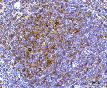 NCR1 Rabbit Polyclonal Antibody