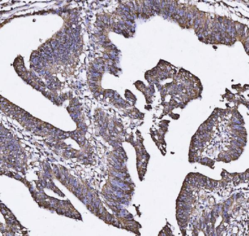 MUC2 Rabbit Polyclonal Antibody