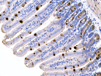 MUC2 Rabbit Polyclonal Antibody