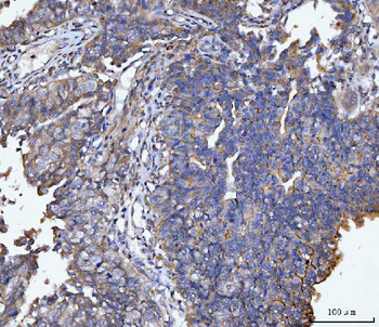 MUC1 Rabbit Polyclonal Antibody
