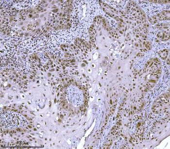 JHDM3A/JMJD2A/KDM4A Rabbit Polyclonal Antibody