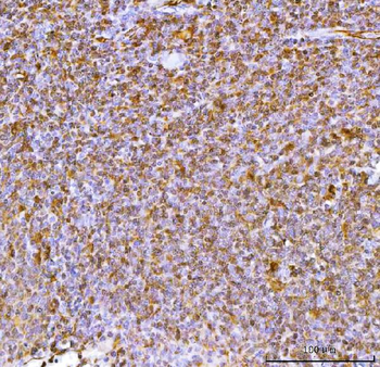 IL34 Rabbit Polyclonal Antibody