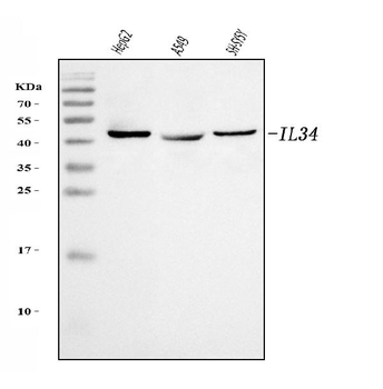 IL34 Rabbit Polyclonal Antibody