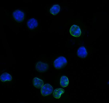 Il2ra Rabbit Polyclonal Antibody