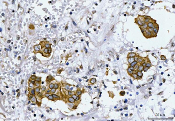 HER2/ERBB2 Rabbit Polyclonal Antibody
