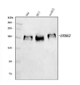 HER2/ERBB2 Rabbit Polyclonal Antibody