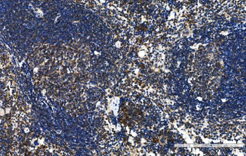 Cxcr5 Rabbit Polyclonal Antibody