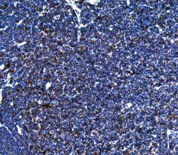 Cxcr5 Rabbit Polyclonal Antibody