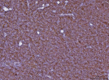 Cxcr3 Rabbit Polyclonal Antibody