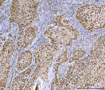 CUX1 Rabbit Polyclonal Antibody