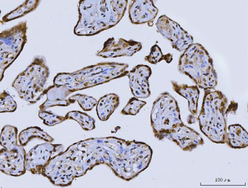 CUX1 Rabbit Polyclonal Antibody